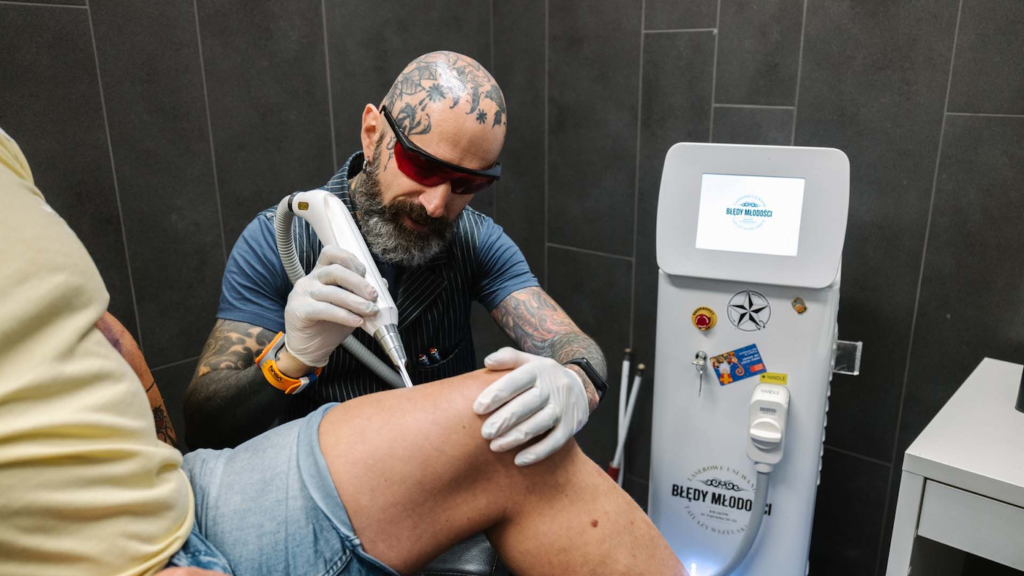 Jak działają lasery do usuwania tatuażu?